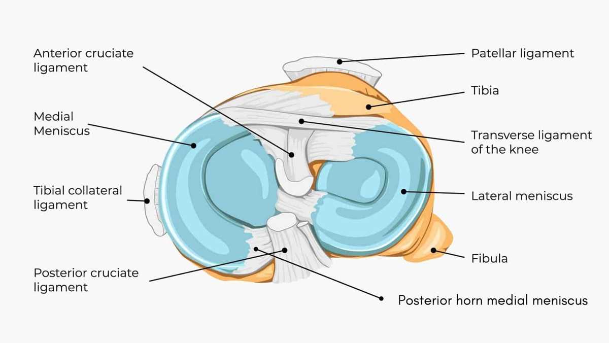 schematic diagram posterior horn medial meniscus