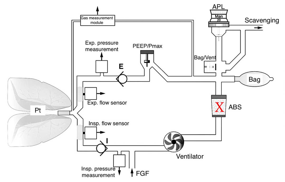 anesthesia circuit diagram