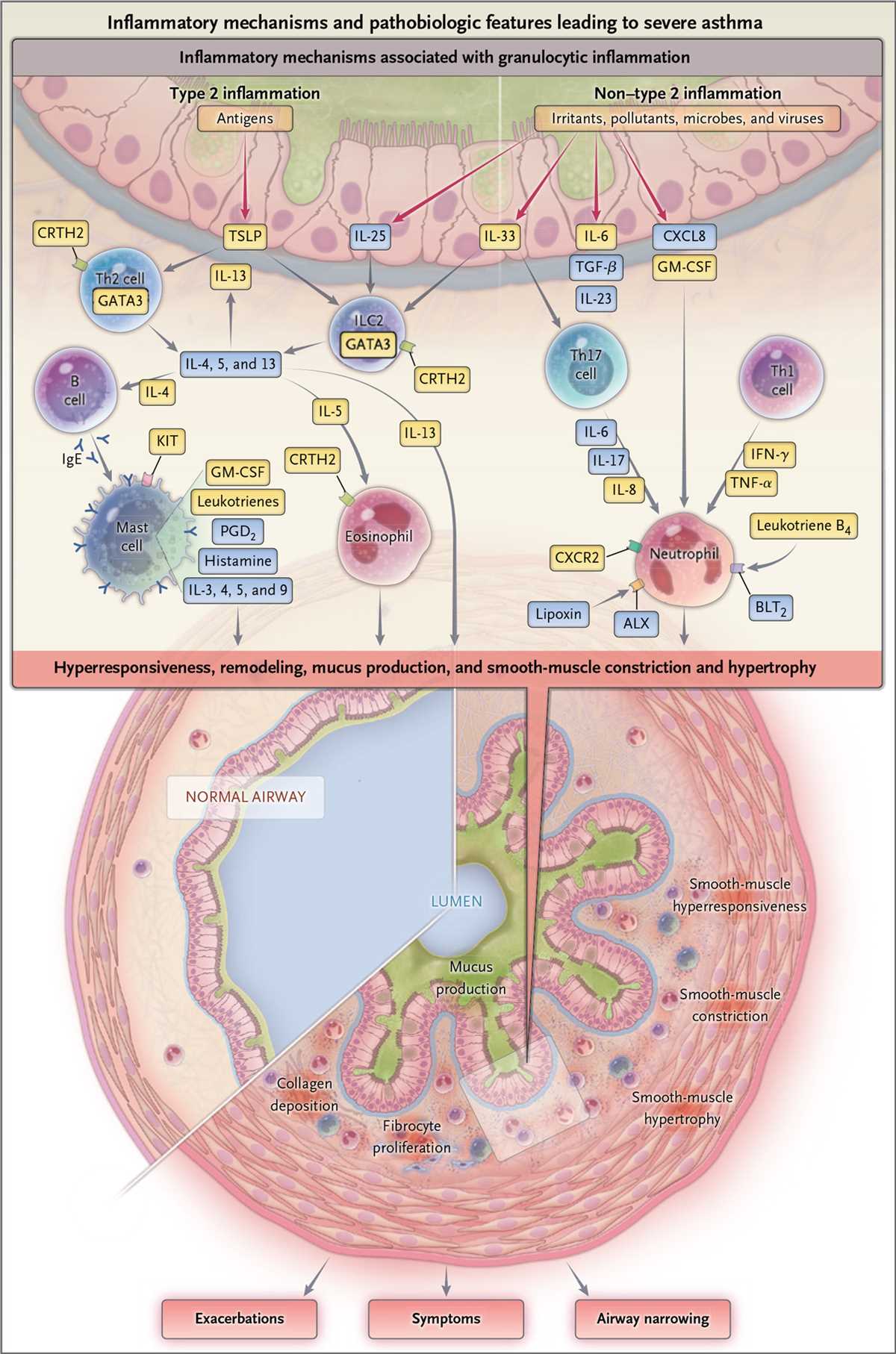 asthma pathophysiology schematic diagram