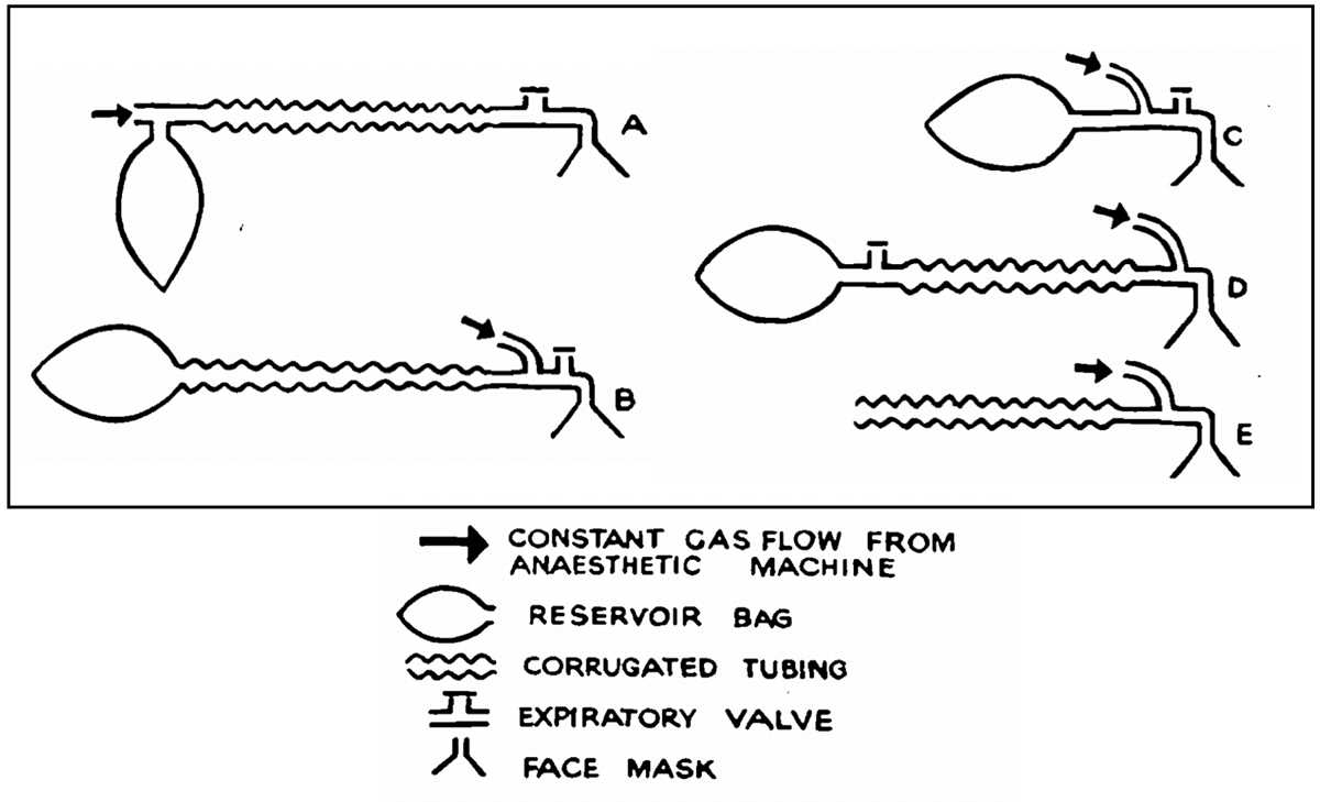anesthesia circuit diagram