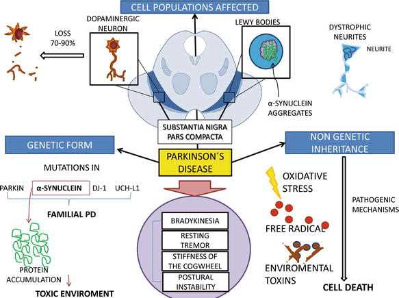 parkinsons disease pathophysiology schematic diagram