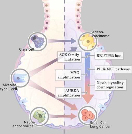 pathophysiology lung cancer schematic diagram