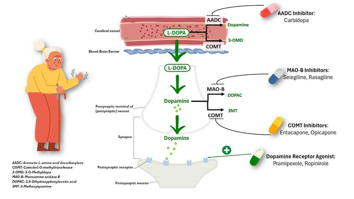 parkinsons disease pathophysiology schematic diagram