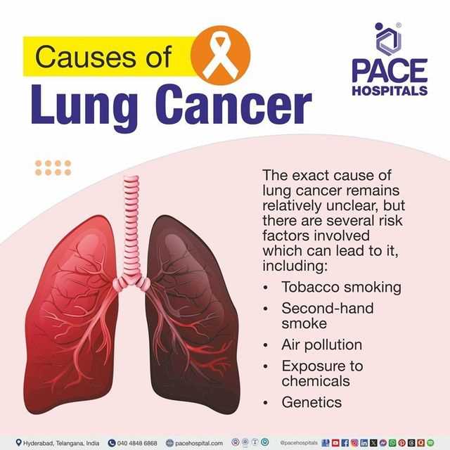 pathophysiology lung cancer schematic diagram
